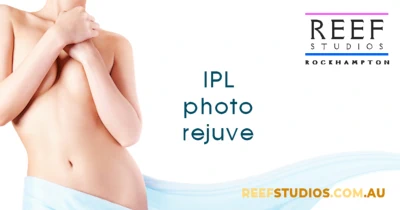 IPL photo rejuvenation treatments are available at Reef Studios, Rockhampton