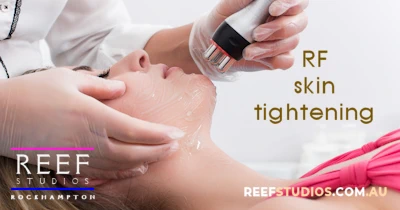 RF Skin Tightening treatments available at Reef Studios, Rockhampton