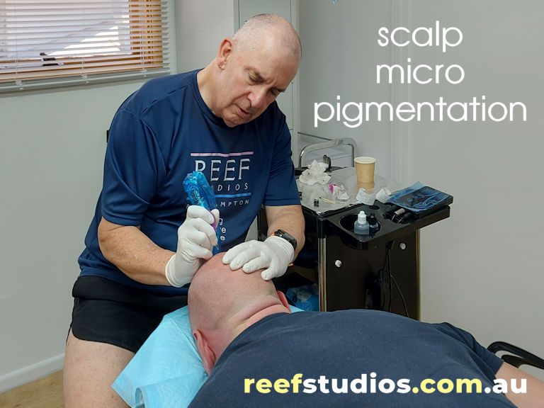 SMP Scalp Micropigmentation Treatment being performed by Rockhampton technician, Andrew Thompson at Reef Studios
